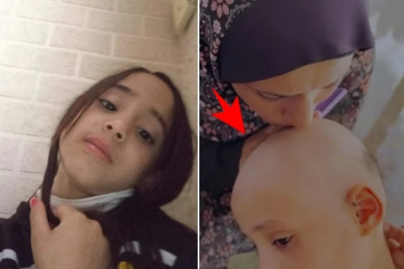 “엄마, 죽고 싶어요” 머리 다 빠진 8세 소녀 사연…전쟁의 참혹한 민낯 기사 요약